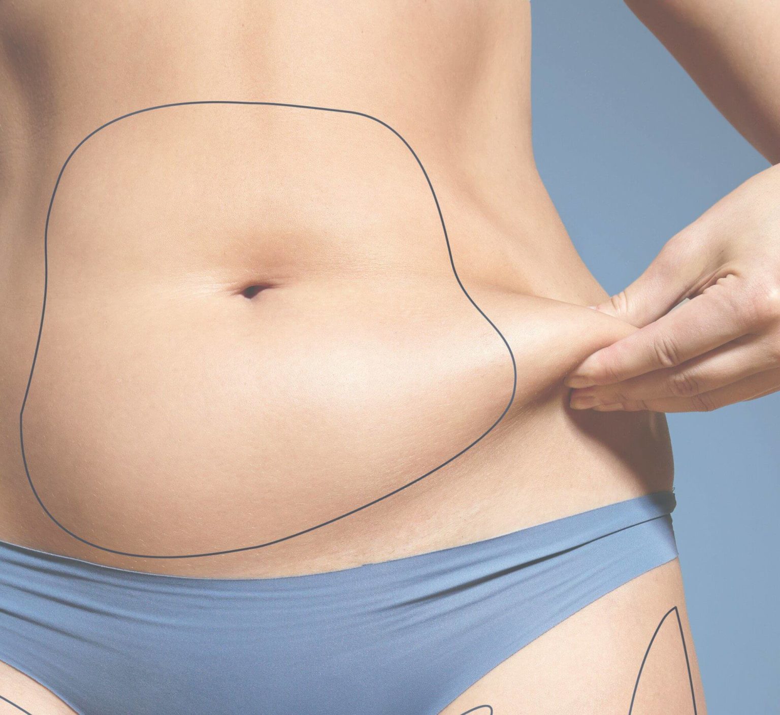 Are You a Good CoolSculpting Candidate?