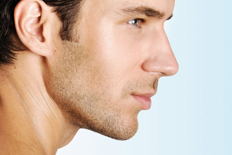 Contour Your Jawline with Kybella